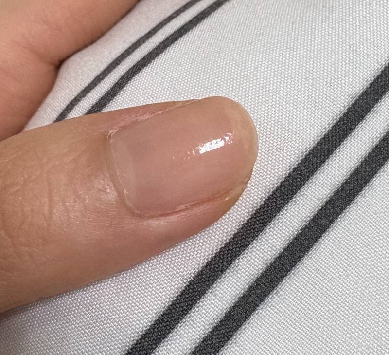 [잡담] 하 젤네일로 벗겨진 손톱 원상복구가 안되는데 도와줘 | 인스티즈