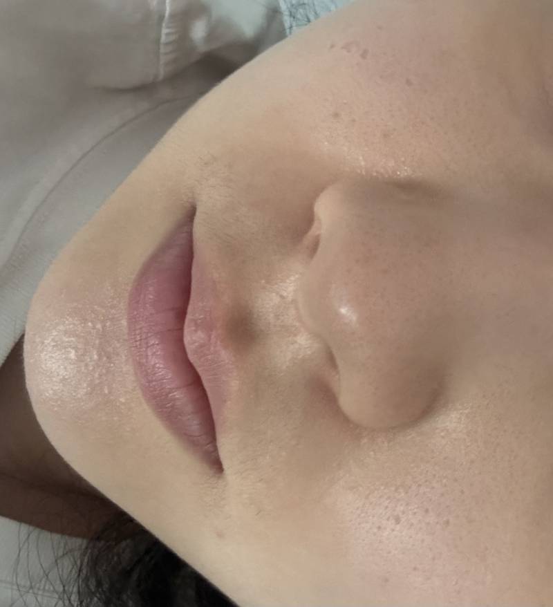 [잡담] 내 피부인데 시술이나 관리? 어케 해야되는지 알려주라 ㅜㅜㅜ | 인스티즈