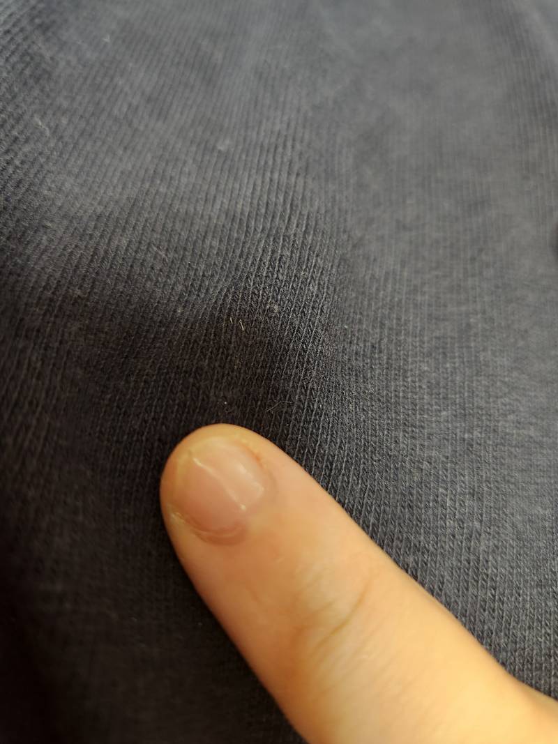 [잡담] 나 3n년 만에 손톱 뜯는 버릇 고치는 중인데 어때? | 인스티즈