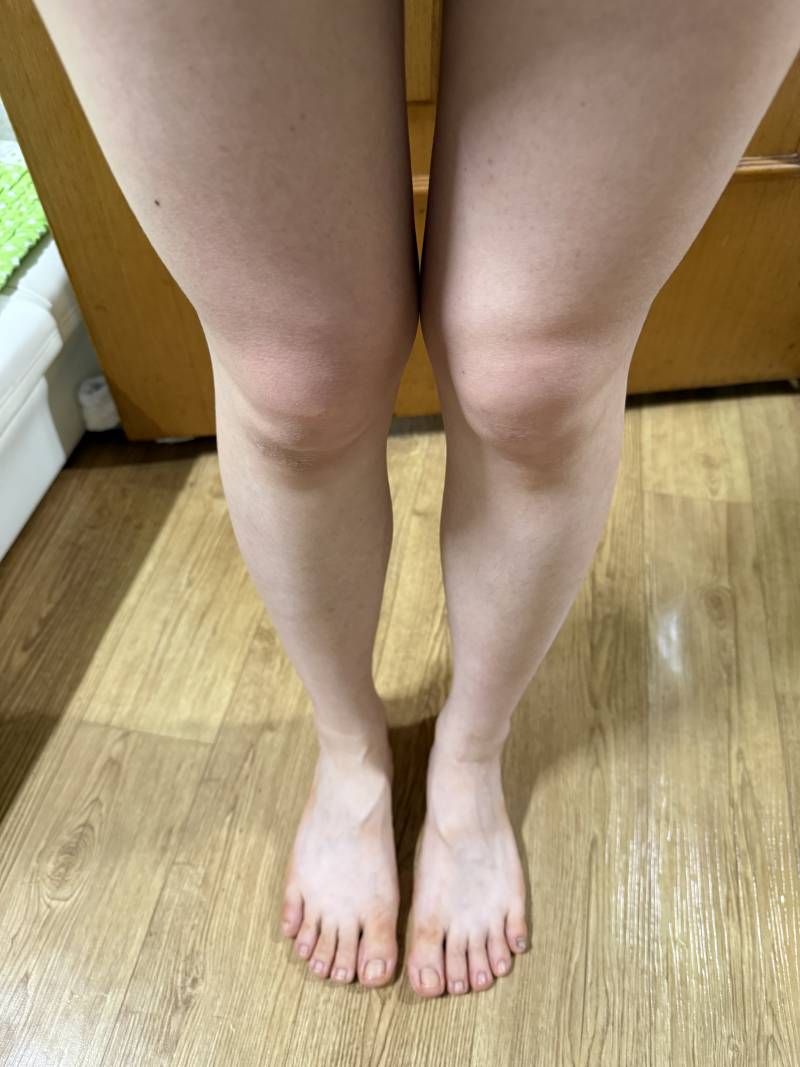 [잡담] 다리살 어떻게 빼?? | 인스티즈