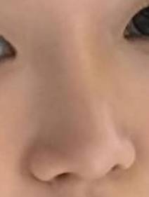 [잡담] 난 코수술 하고 자존감이 진짜 달라짐 | 인스티즈