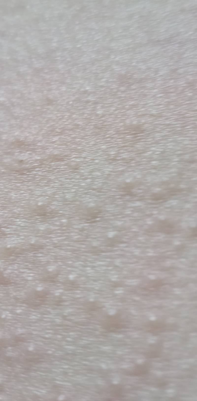 [잡담] 이거혹시뭘까?ㅜㅜ 사진피부주의! | 인스티즈