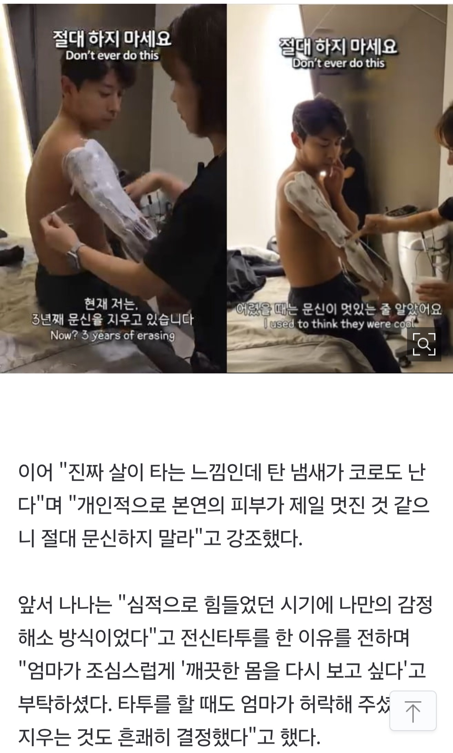 [잡담] 곽윤기 3년째 타투 제거중 | 인스티즈