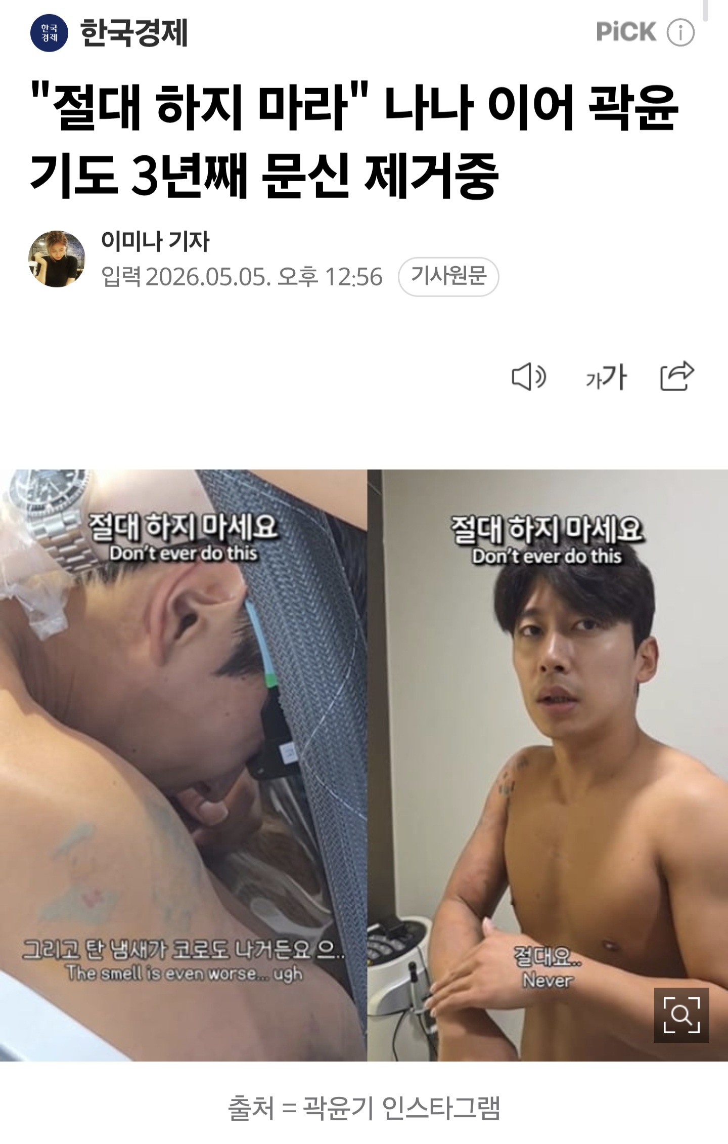 [잡담] 곽윤기 3년째 타투 제거중 | 인스티즈