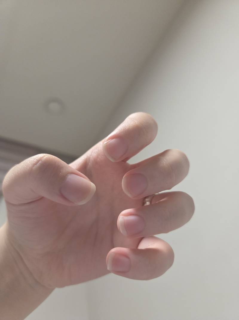 [잡담] 손톱길이 이정도인데 네일 받으려면 연장 하는게 나을까? | 인스티즈