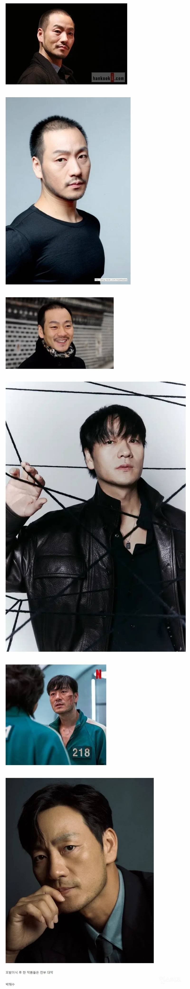모발이식 후 초대박난 배우 ㄷㄷ ㄷㄷ ㄷㄷ ㄷㄷ.jpg | 인스티즈