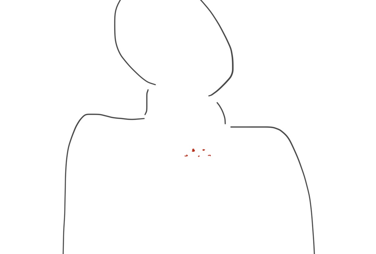 [잡담] 오잉? 갑자기 가드름이 이맇게 5개가 나있어 | 인스티즈