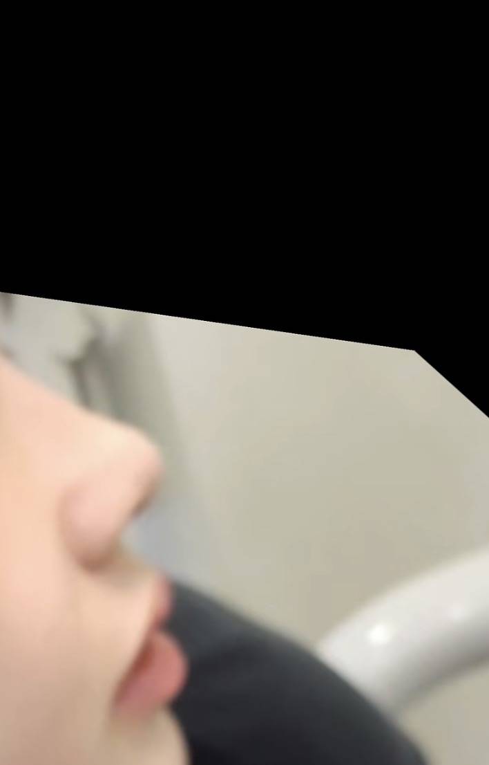 [잡담] 코수술 하고싶어 | 인스티즈