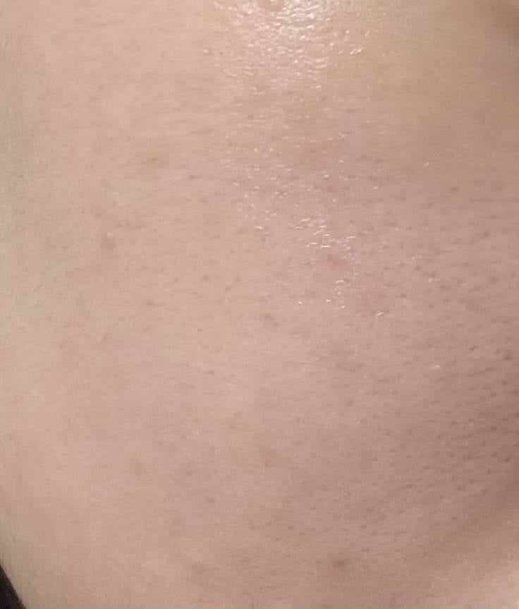 [잡담] 피부 좀 좋아진거 맞ㄷ지...? | 인스티즈