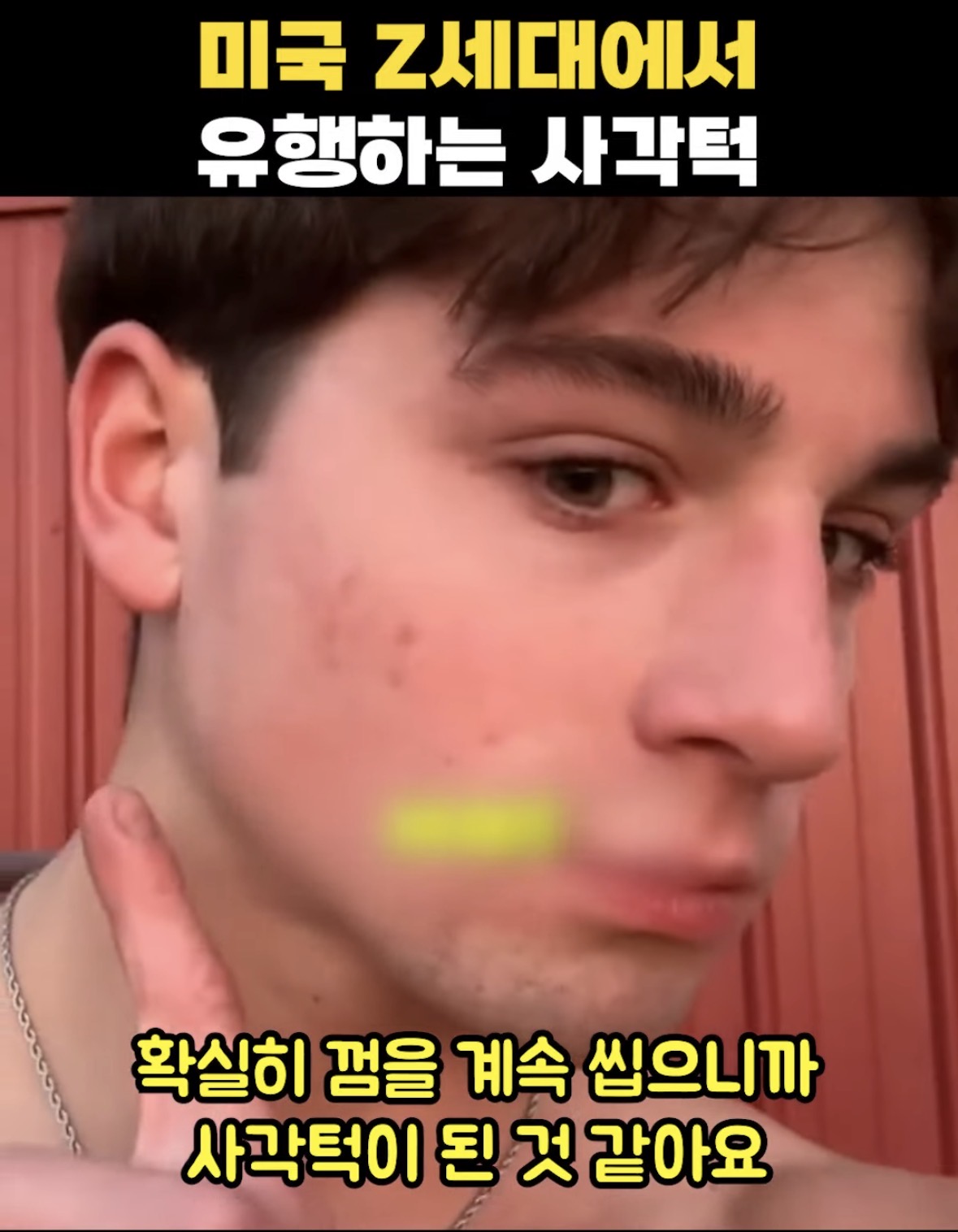 [잡담] 플무 미국은 사각턱 만들기가 유행이래 | 인스티즈