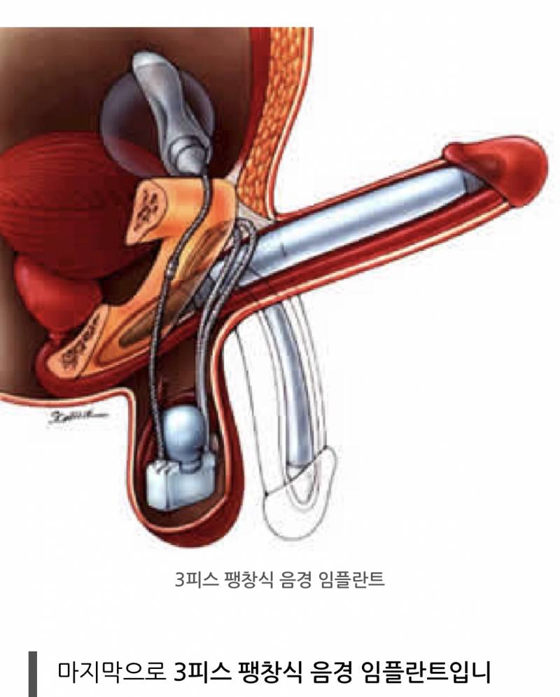 [잡담] 트젠 왜케 정신병 같지 | 인스티즈