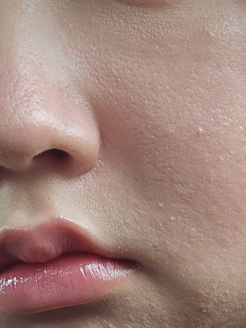 [잡담] 화장으로 커버했는데도 피부 이래... 어떡해? (ㅎㅇㅈㅇ) | 인스티즈