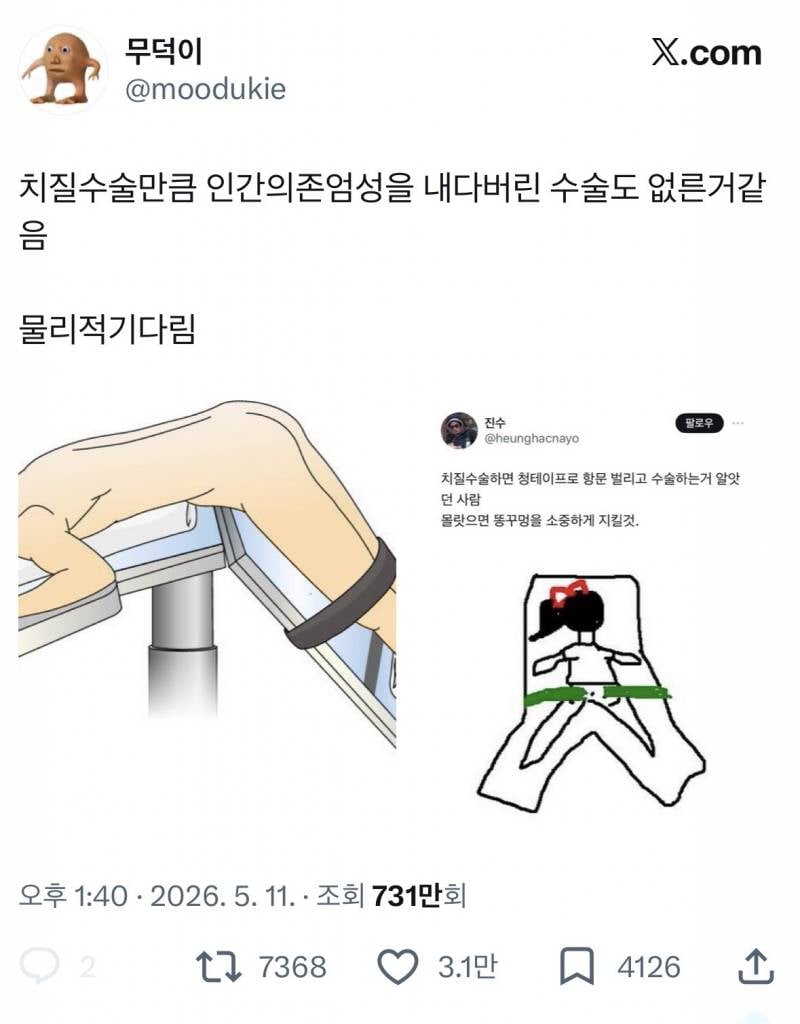 현재 인간의 존엄성을 박살낸다는 수술 원탑..JPG | 인스티즈