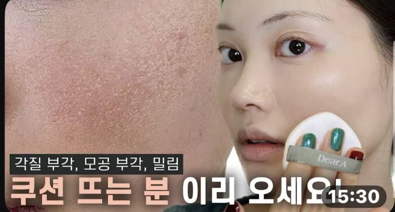 [잡담] 피부 뜨는거 어떻게 해결해..? ㅠㅠ | 인스티즈