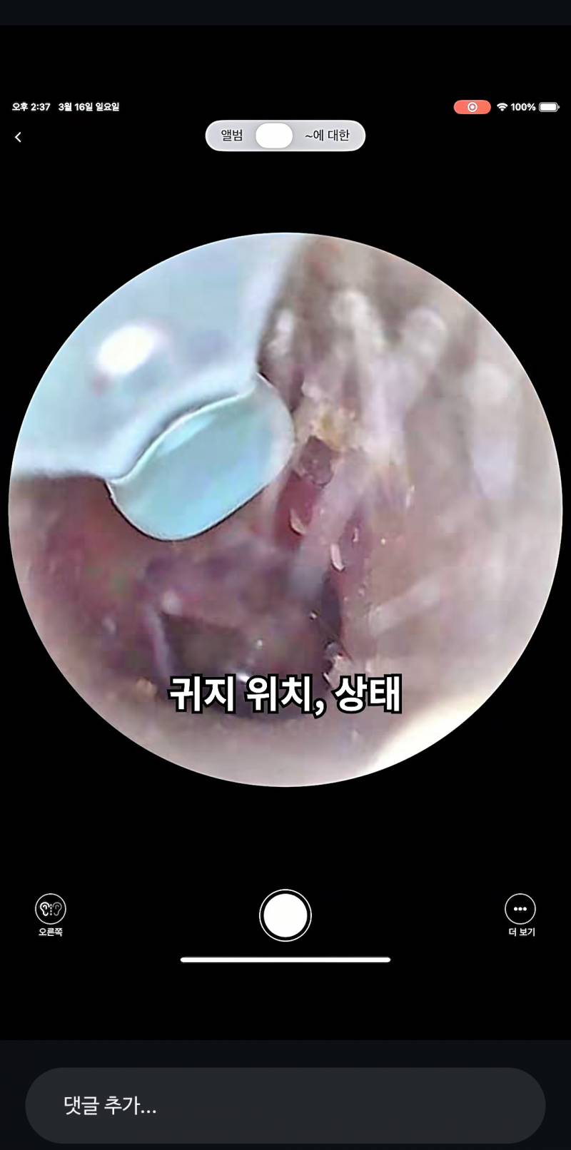 [잡담] 귀파는거 이거 어때?? | 인스티즈