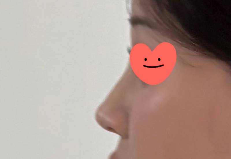 [잡담] 혹시 코 구축온거 아니지ㅜ? | 인스티즈