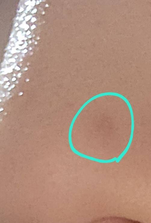 [잡담] 이거 흉진거야? 어떻게 없어짐? 시간지나면? | 인스티즈