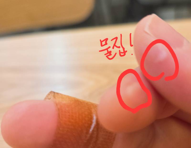 [잡담] 악기치니까 손이 성할 날이 없어 | 인스티즈