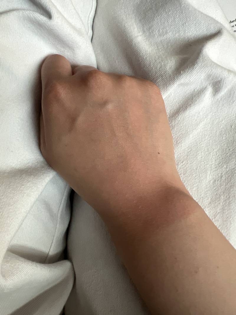 [잡담] 오늘 햇빛 겁나 뜨거움 손등만 탐 | 인스티즈