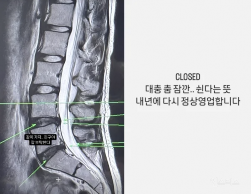 허리디스크 심각했던 이채연 요즘 퍼포 수준 .gif | 인스티즈