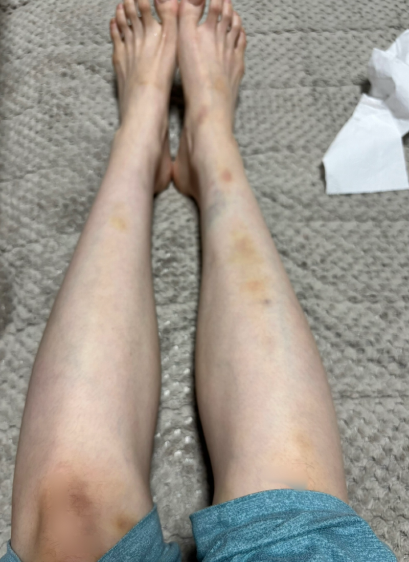 [잡담] 나 다리멍봐............ | 인스티즈