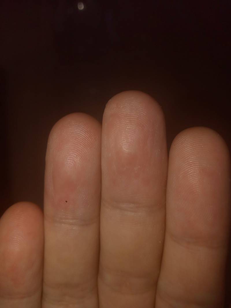 [잡담] 날이 건조하니 손가락 껍질 벗겨지네........ | 인스티즈