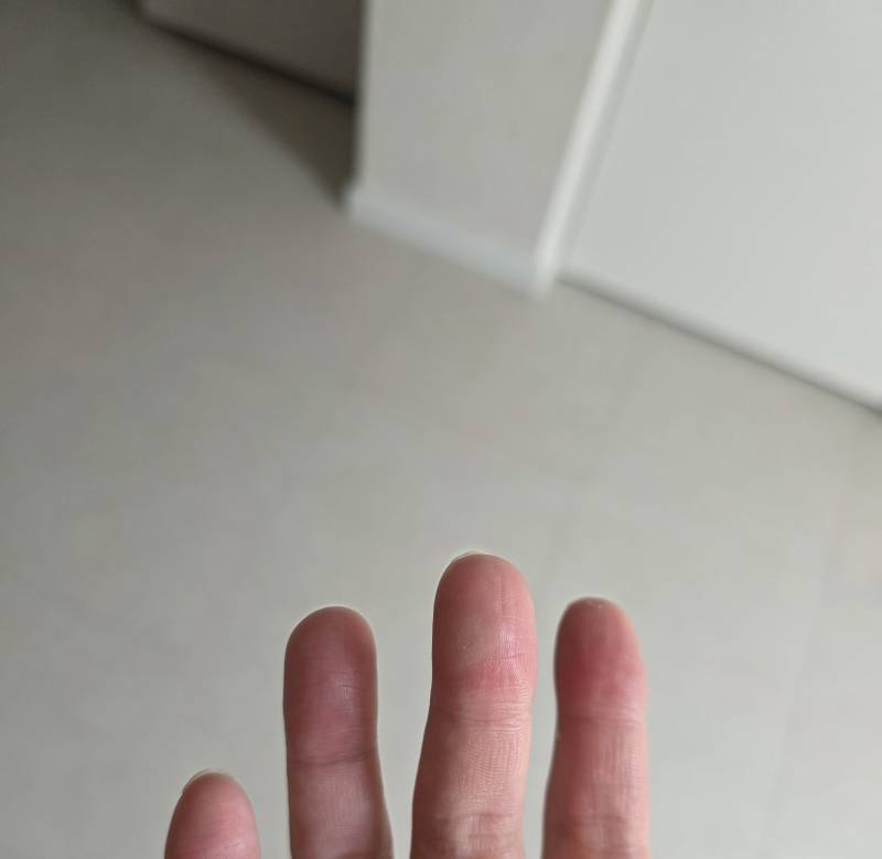 [잡담] 락스물에 닿아서 그런지 손가락이 | 인스티즈