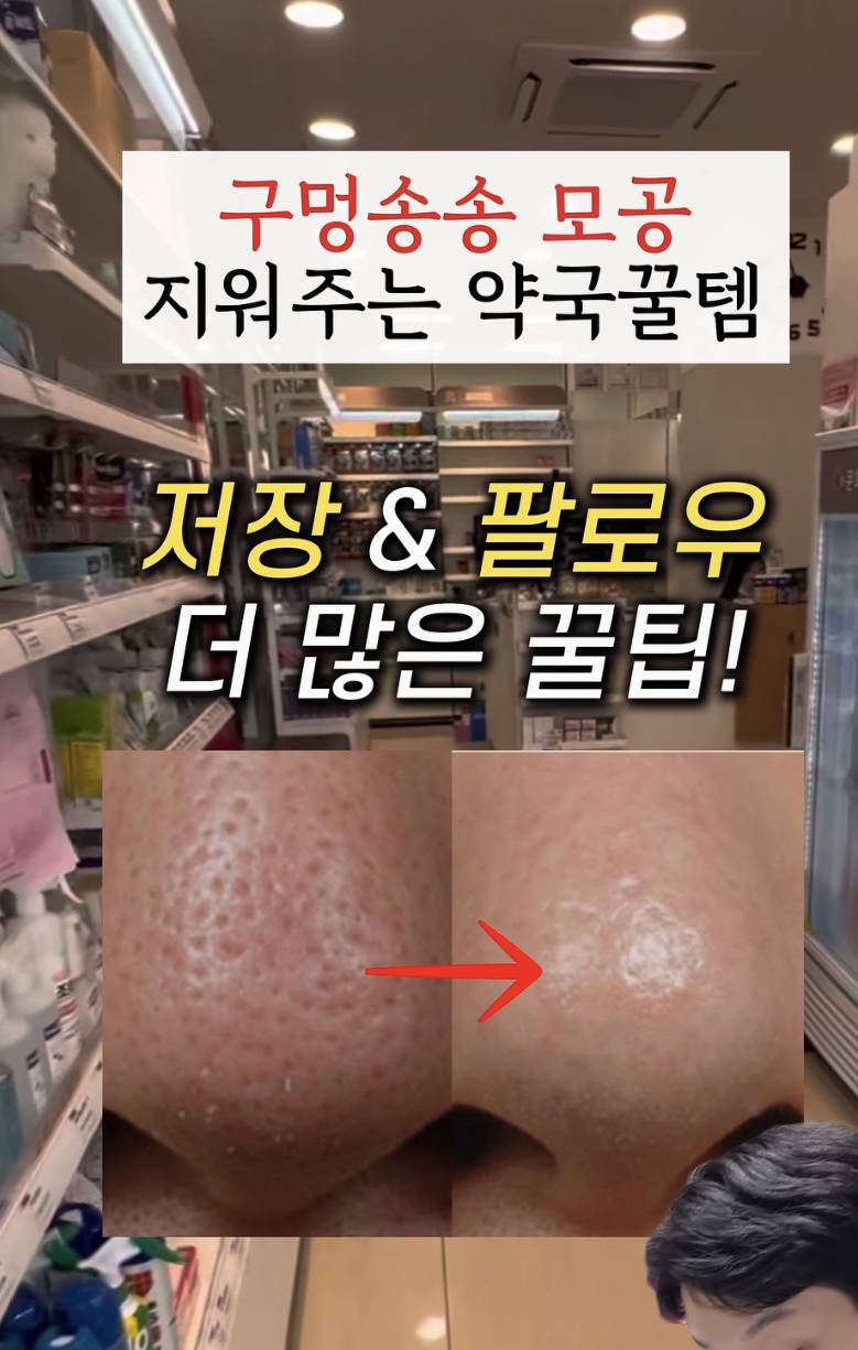 [잡담] 모공 이게 가능해? | 인스티즈