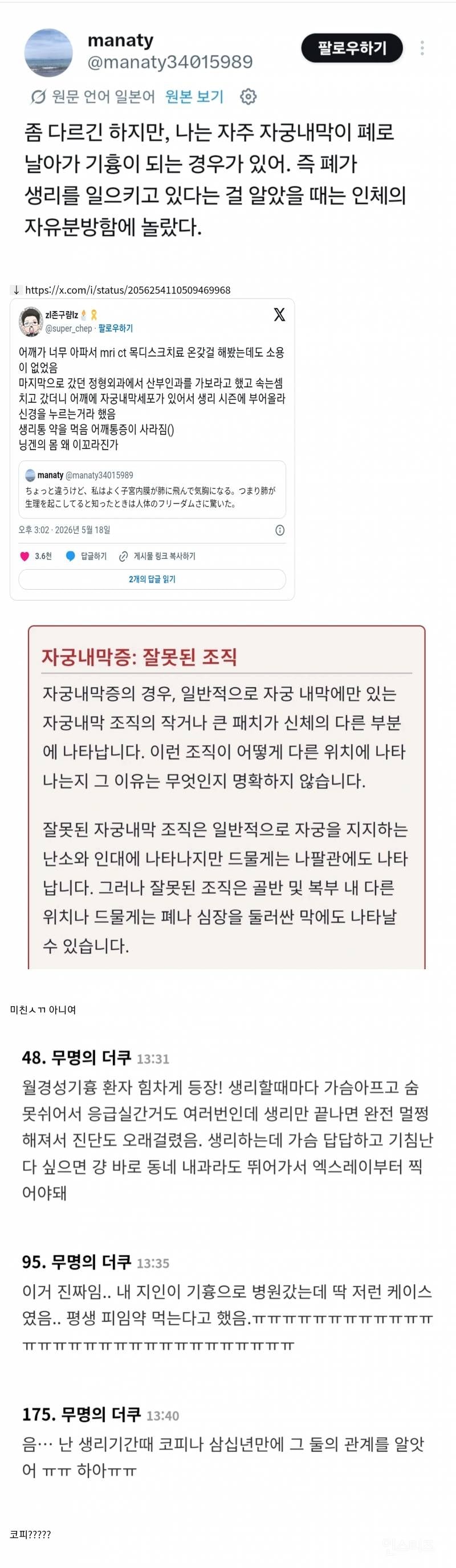 ♀️자궁에서 탈출한 자궁세포가 엉뚱한 부위에서 생리통 유발 | 인스티즈