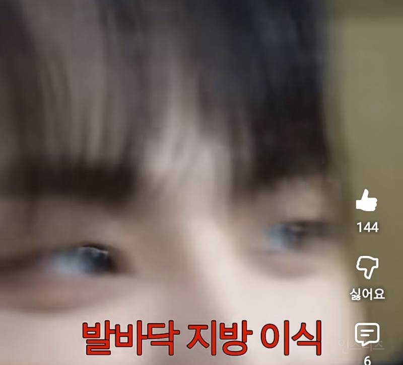 발바닥 지방이식이 하고싶어진 남돌...jpg | 인스티즈