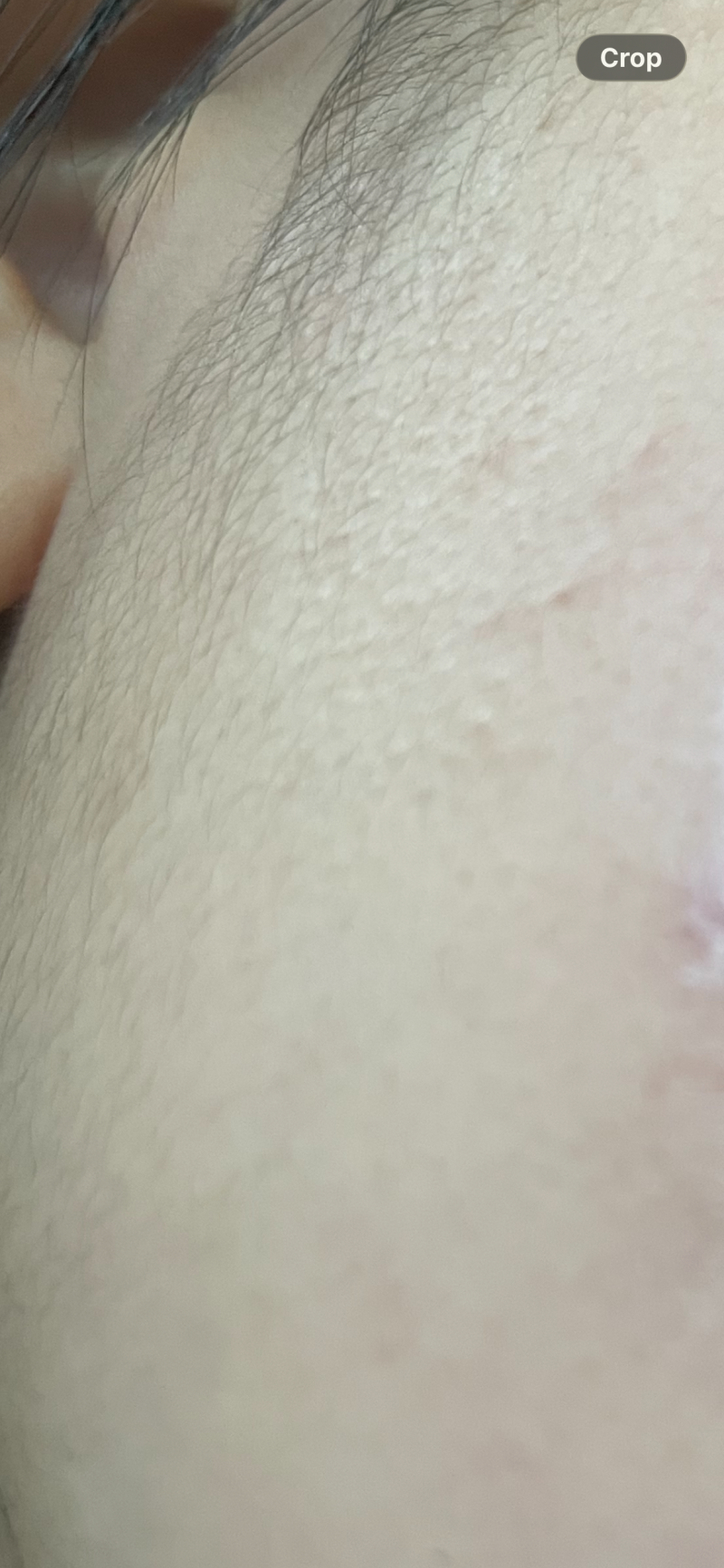[잡담] 나 다모증인가?? 진화 덜됐나?? 남자인가?? | 인스티즈