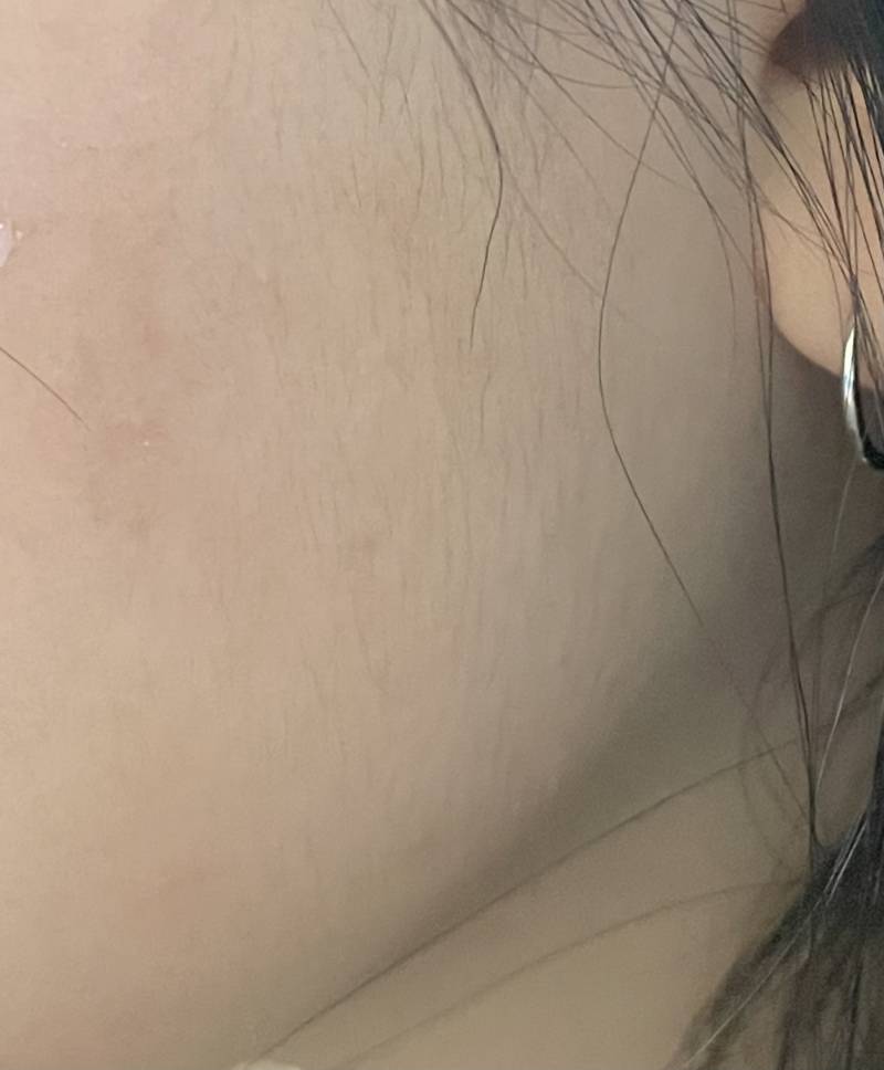 [잡담] 나 다모증인가?? 진화 덜됐나?? 남자인가?? | 인스티즈