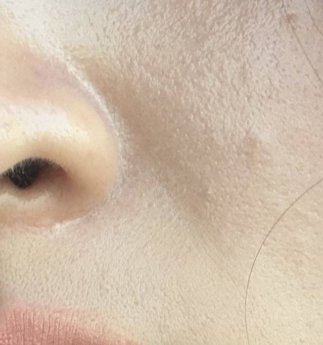 [잡담] 21살에 팔자주름 이정도면 심한건가?ㅠ | 인스티즈
