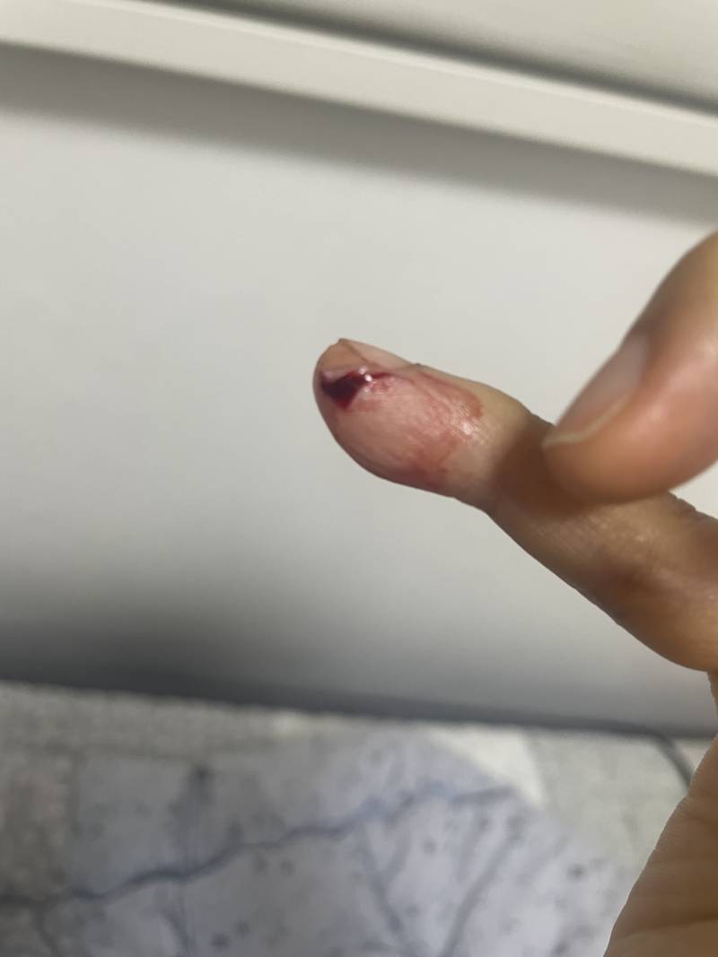 [잡담] 간호사님 계신가요? 급해요 | 인스티즈