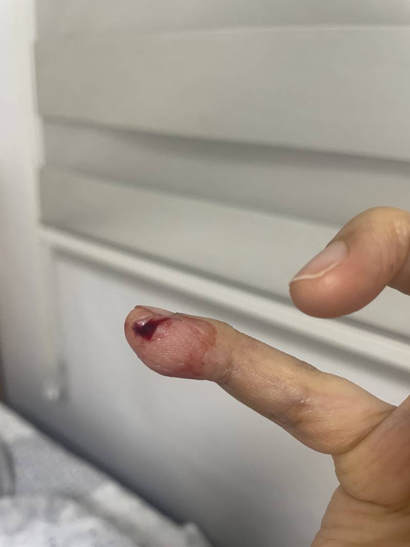 [잡담] 간호사님 계신가요? 급해요 | 인스티즈
