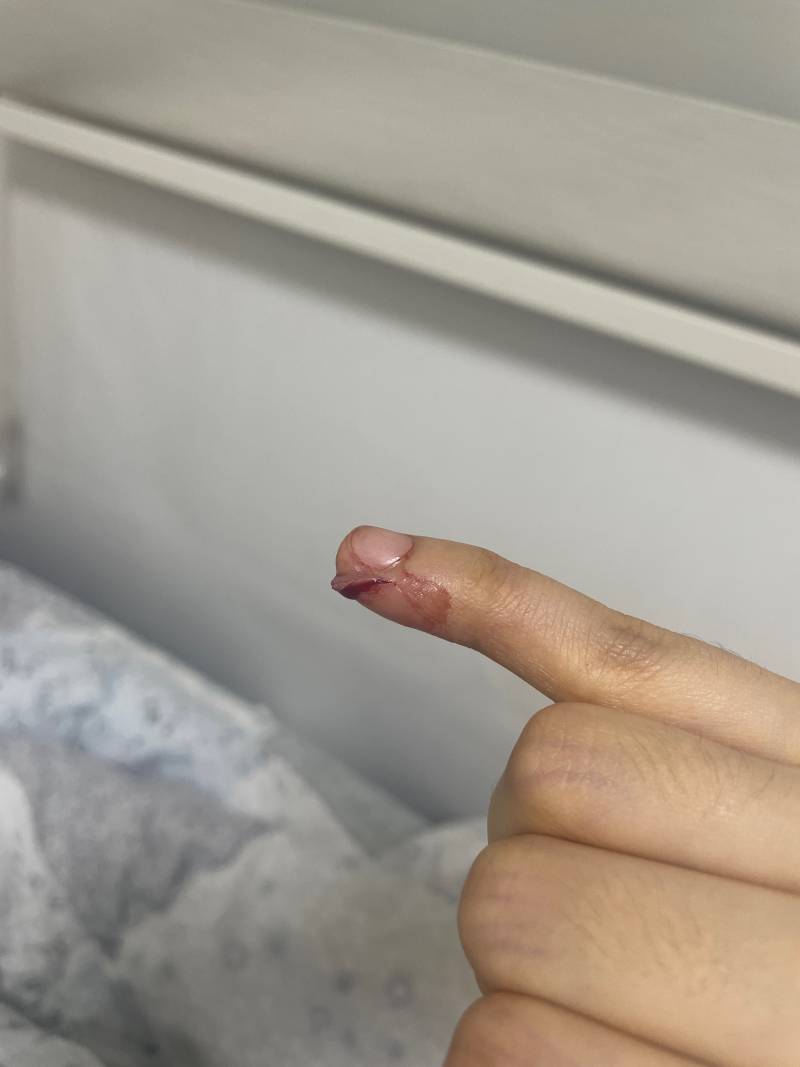 [잡담] 간호사님 계신가요? 급해요 | 인스티즈