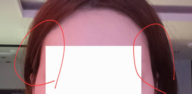 [잡담] 귀에 머리꽂으면 저렇게도ㅔ는데 | 인스티즈