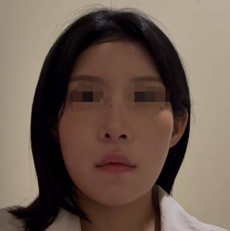 [잡담] 익들 나 붙머 어울릴 얼굴형인지 봐줄수있을까 제발 ..?ㅠㅠ!!!! | 인스티즈