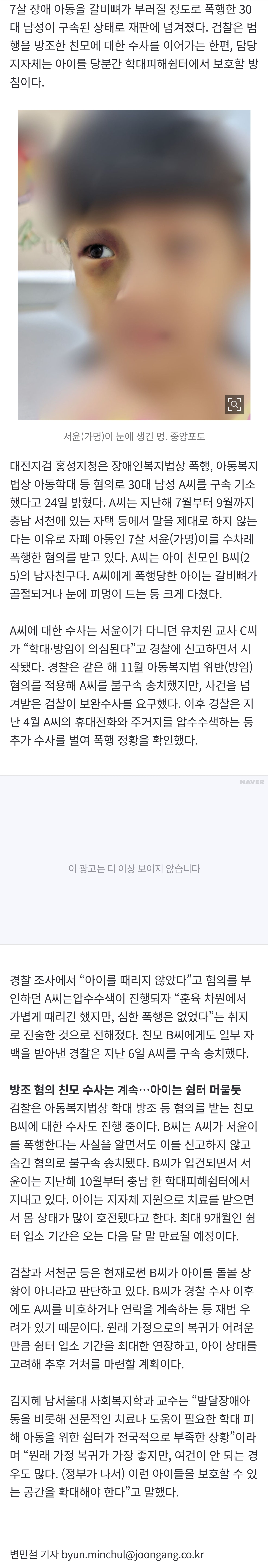 [정보/소식] [단독] 7세 자폐아 갈비뼈 부러지도록 때렸다•••'친모 남친' 구속 기소 | 인스티즈