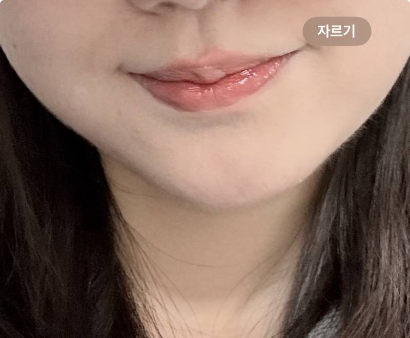 [잡담] 입술필러 맞은지 2년됐는대 맞말맞말 | 인스티즈