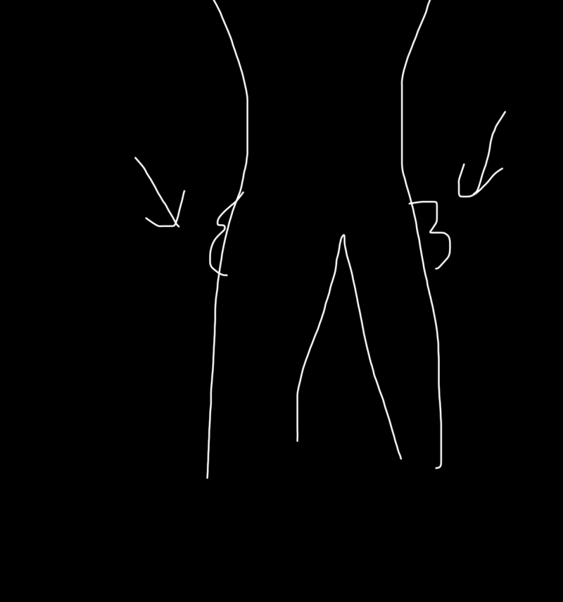 [잡담] 여기살은 어떻게 빼야돼? | 인스티즈
