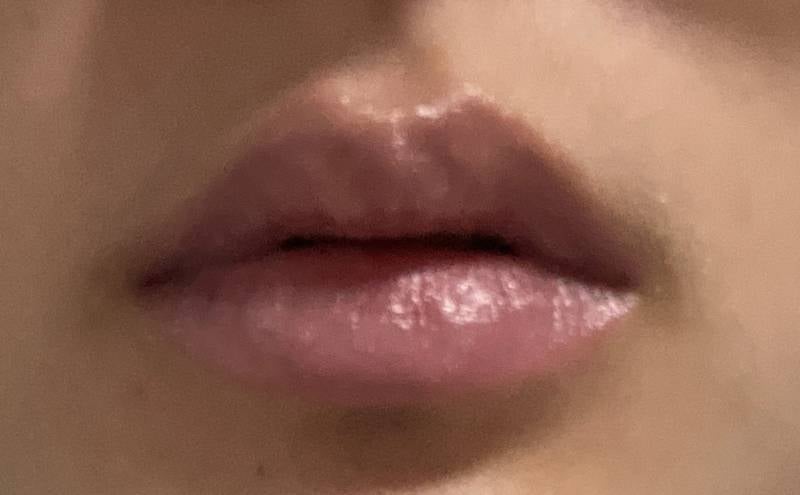 [잡담] 입술필러 할말? | 인스티즈