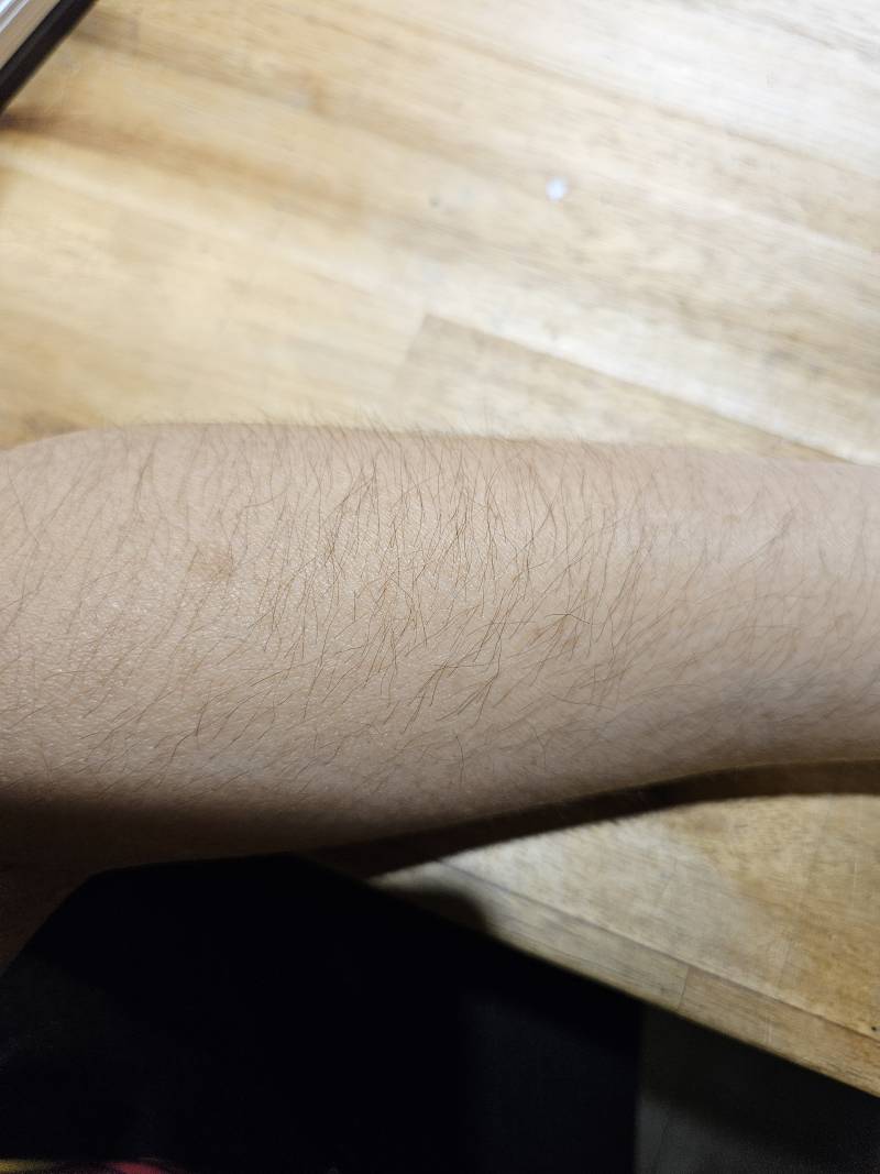 [잡담] 나 팔에 털 개심하지?? 어때 | 인스티즈