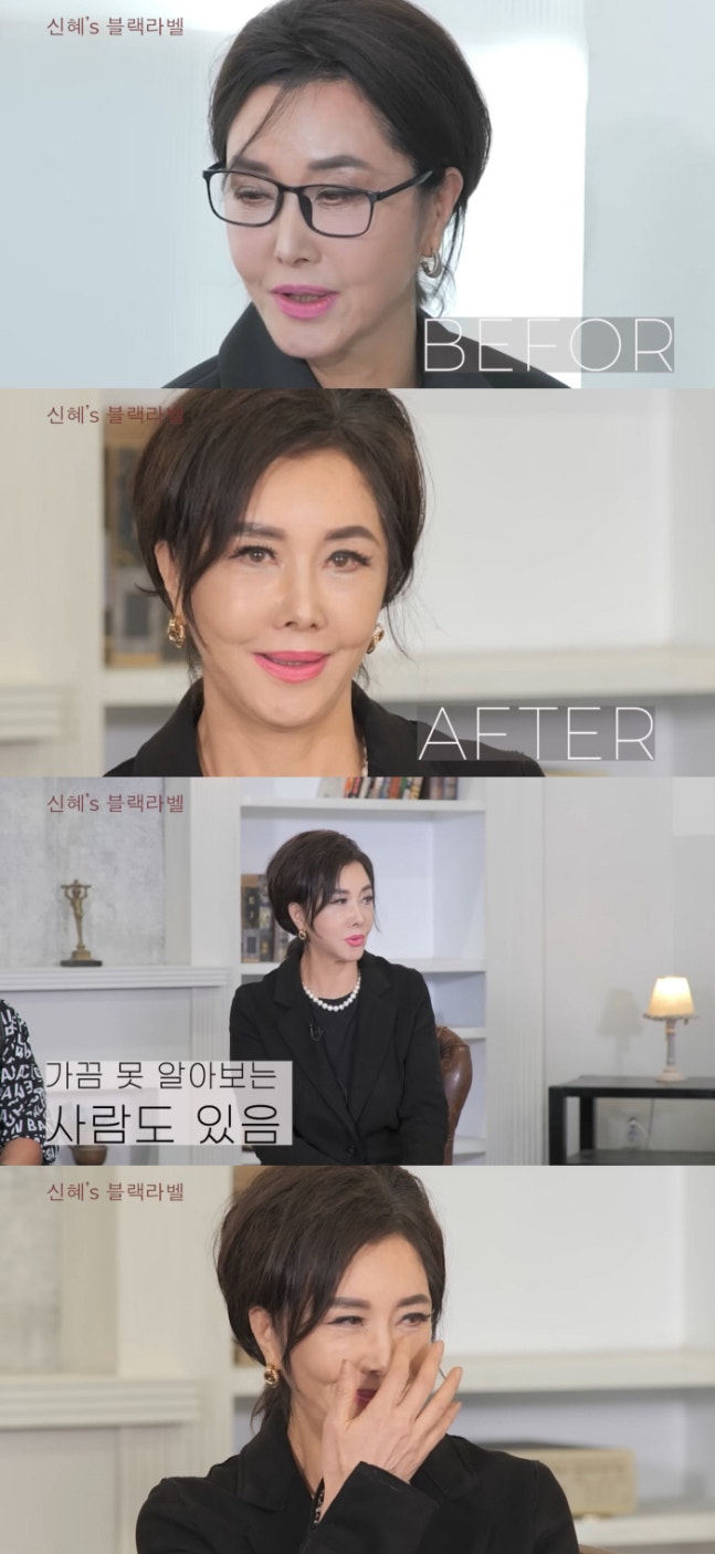 [잡담] 유혜리 배우 안면거상 전후 공개했는데 | 인스티즈