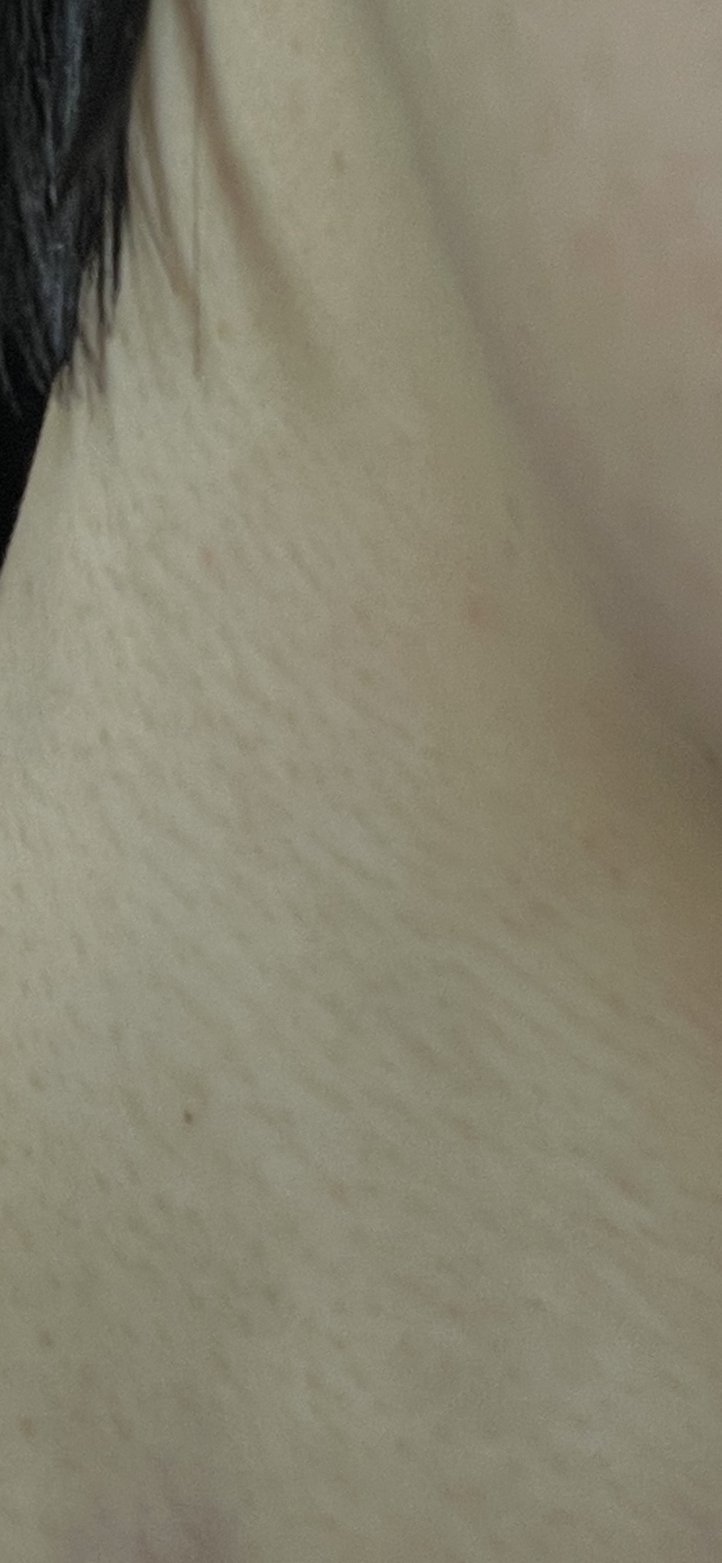 [잡담] 목에 이거 어떻게 없애?ㅠㅠ | 인스티즈