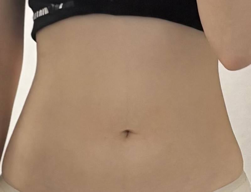 [잡담] 내뱃살보면 몇키로같아? | 인스티즈