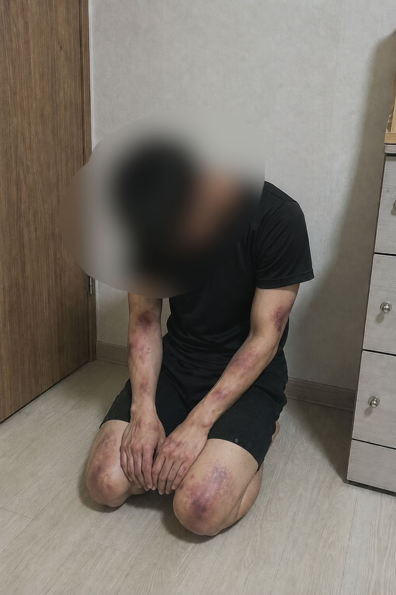 [잡담] 오늘 남동생 개팼다 | 인스티즈