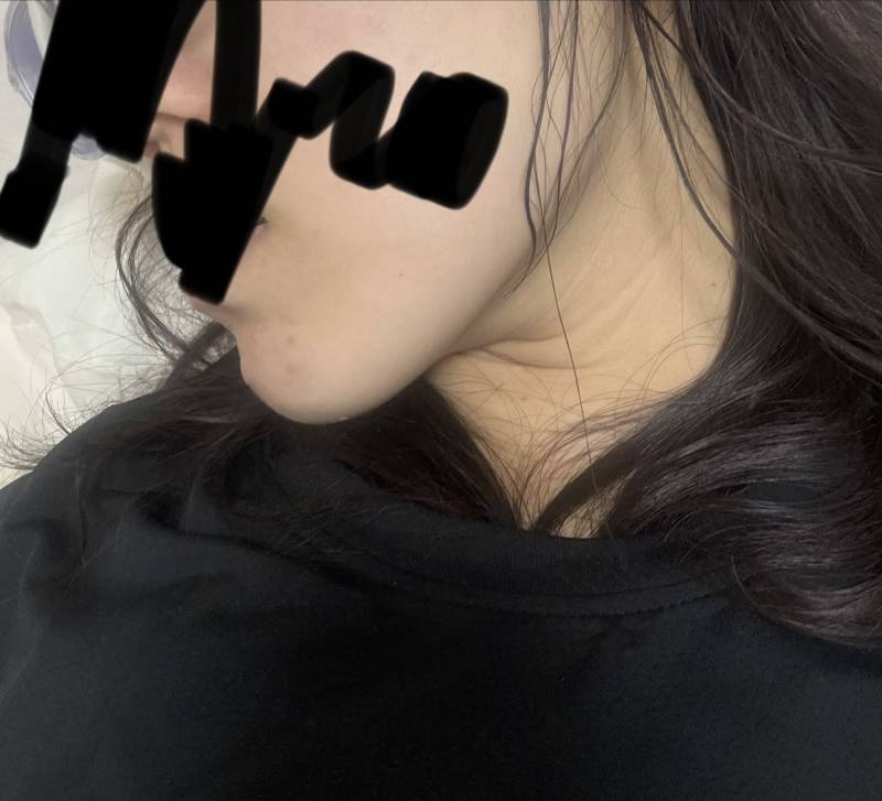 [잡담] 옆턱보다 밑턱이 두드러진편이지? | 인스티즈
