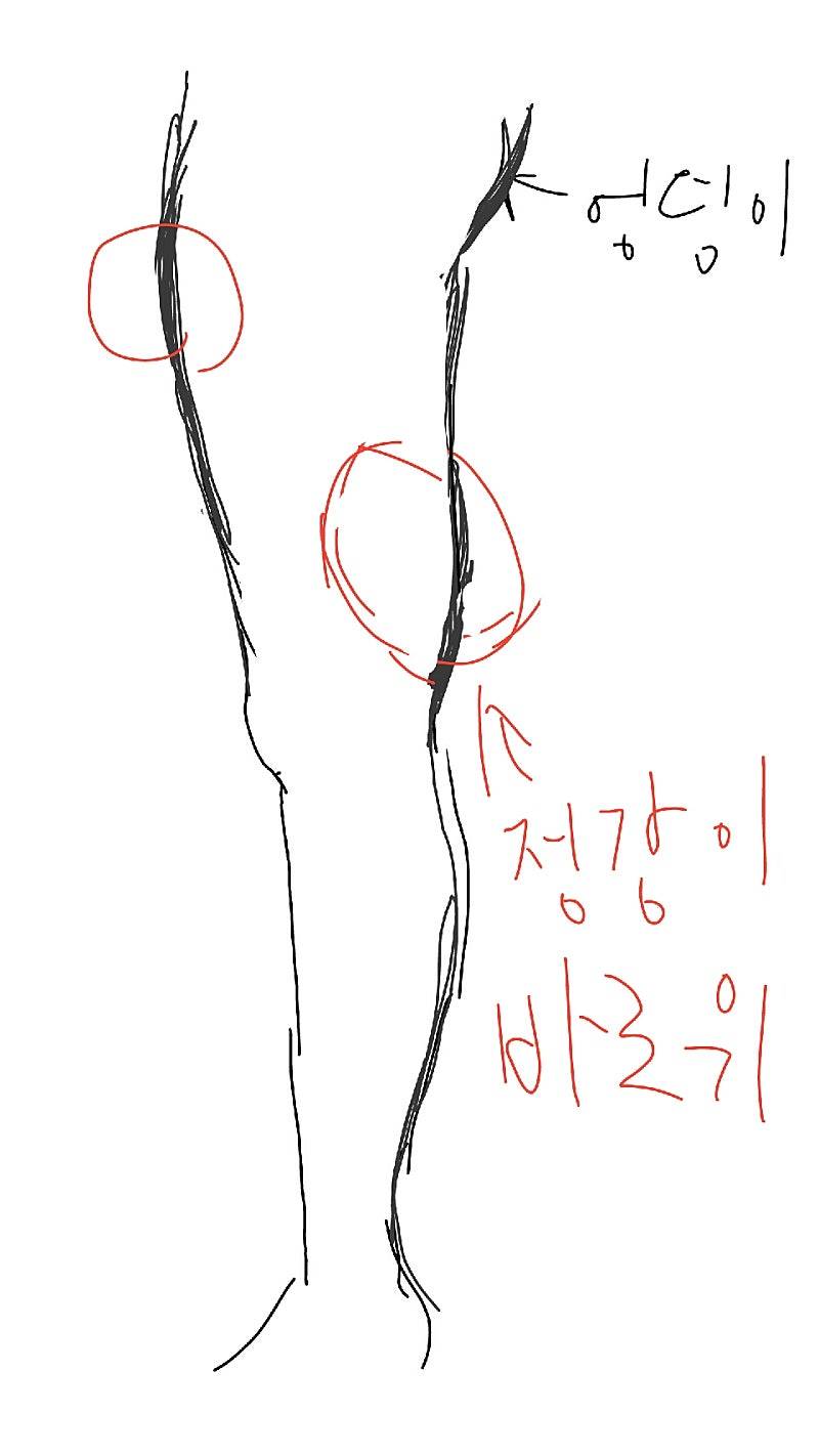 [잡담] 뒷벅지알 어떻게 없애?!?!? | 인스티즈