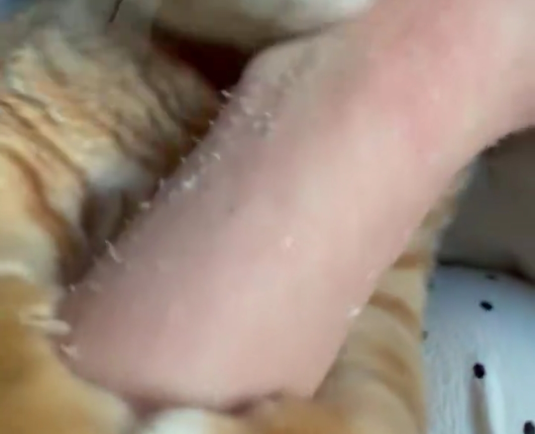 [잡담] 너네 김냄비 고양이 알아? 집사누나분 팔 하도 물어대서 팔 너덜너덜해진거좀봐ㅠㅠㅠㅠㅠㅠ | 인스티즈